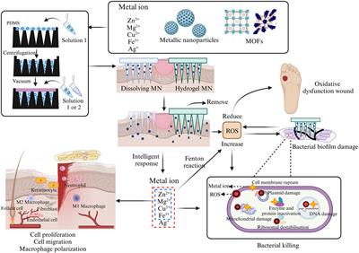 Metallic elements combine with herbal compounds upload in microneedles to promote wound healing: a review